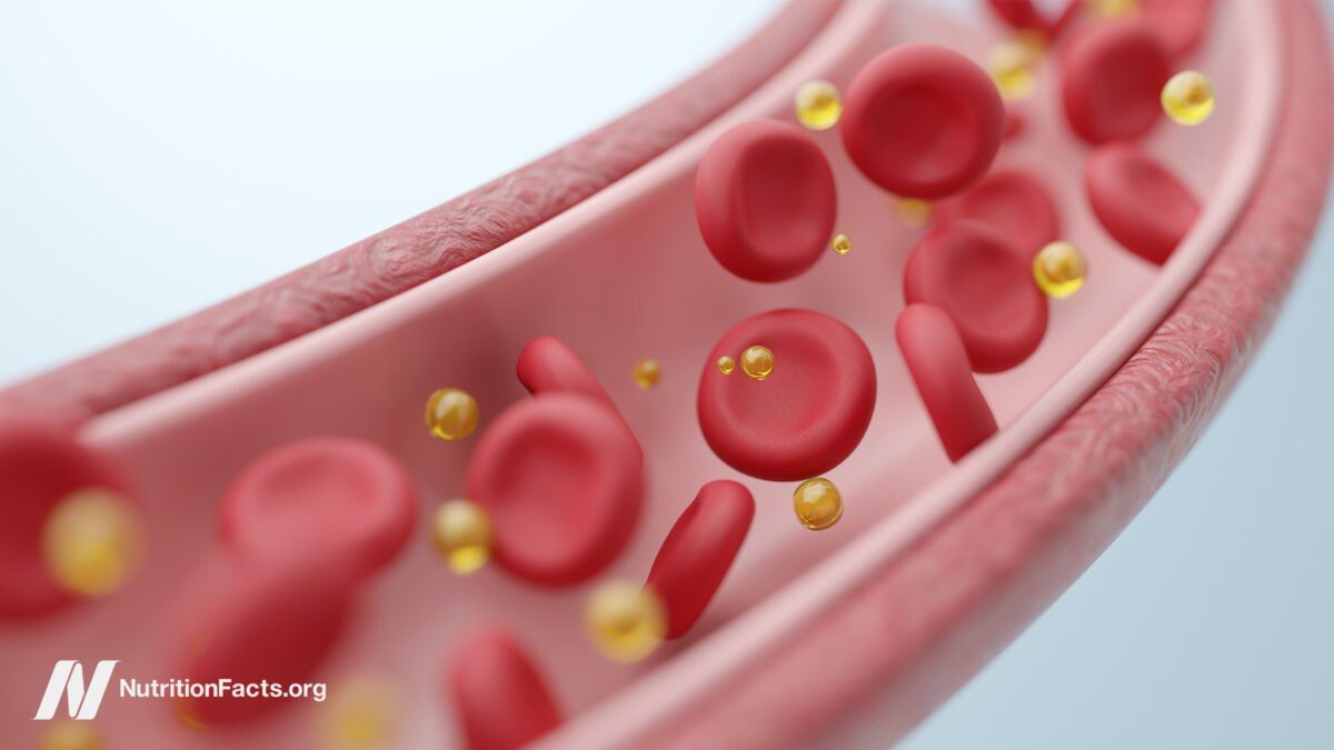 A single high-fat meal impairs your arteries for hours, and your lungs too