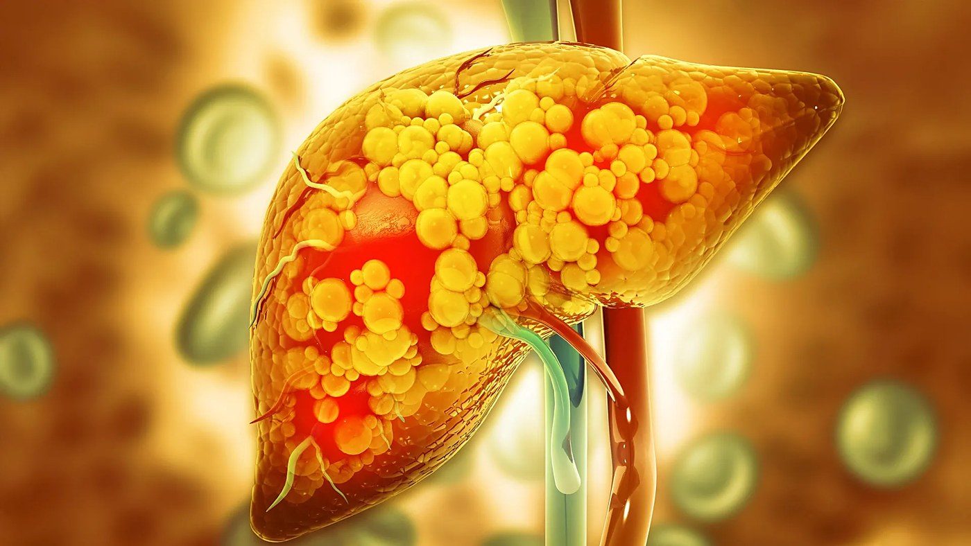 Keto diet beats plant-forward diet at reversing prediabetes in head-to-head trial