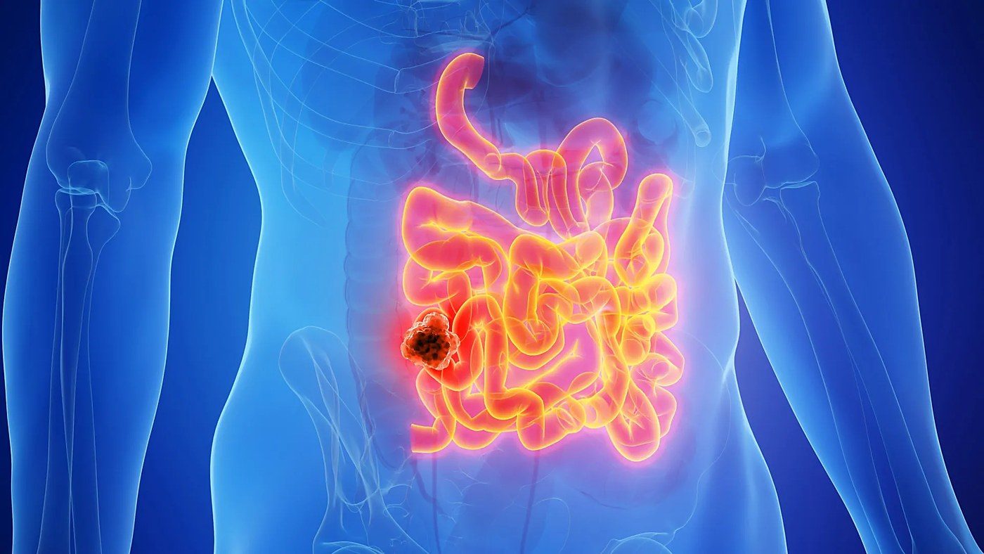 MIT mouse study finds keto raises small-intestinal tumors through fat, not ketones